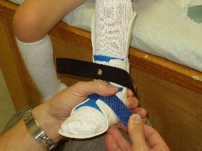 Instructions for use and care of D-DAFO – Pediatric Orthotic Specialists